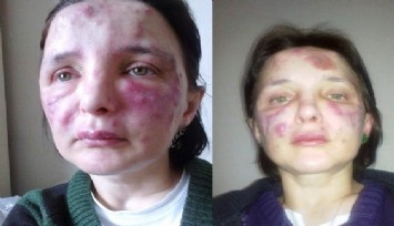 Yüzünü bu hale getiren sahte doktorun cezası belli oldu