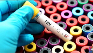 HIV tedavisi için ilk adım