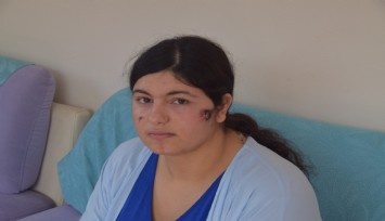 Eşini döven kocaya mahkeme, “Yaralama değil, kasten öldürmeye teşebbüs” dedi