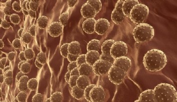 İngiltere'den yayılan gizemli hepatit virüsü, küresel salgın şüphesi uyandırıyor