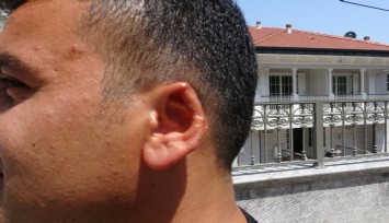 Kavgada kopan kulağını martı kaptı