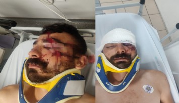 Maddi hasarlı trafik kazası sonrası çıkan kavgada komalık oldu