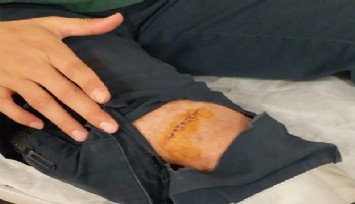 İzmir'deki hastanede dehşet: Kendisini tedavi eden sağlık çalışanına makasla  saldırdı