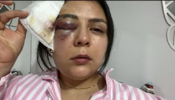Kahramanmaraş'ta sokakta yürürken saldırıya uğradı: Sağ gözüme perde indi, sol gözümden kanlar aktı