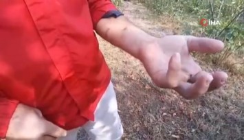 Bolu'da ayı saldırısına uğrayan adam o anları anlattı: 'Parmağımı kopardı'
