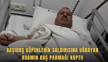 Başıboş köpeklerin saldırısına uğrayan adamın baş parmağı koptu