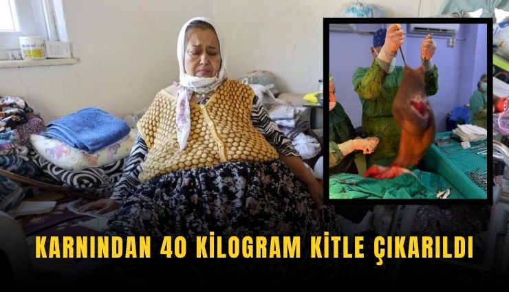 Karnından 40 kilogram kitle çıkarıldı