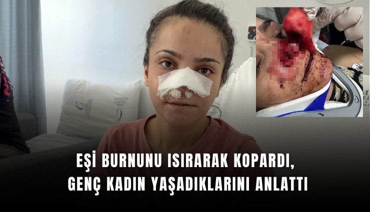 Eşi burnunu ısırarak kopardı, genç kadın yaşadıklarını anlattı