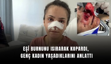 Eşi burnunu ısırarak kopardı, genç kadın yaşadıklarını anlattı